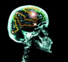 imagen: Pon a prueba tu cerebro